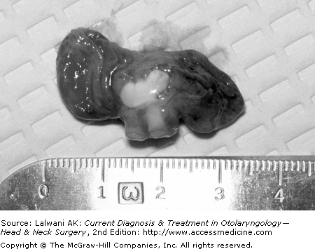 25. Temporomandibular Disorders  Current Diagnosis and 